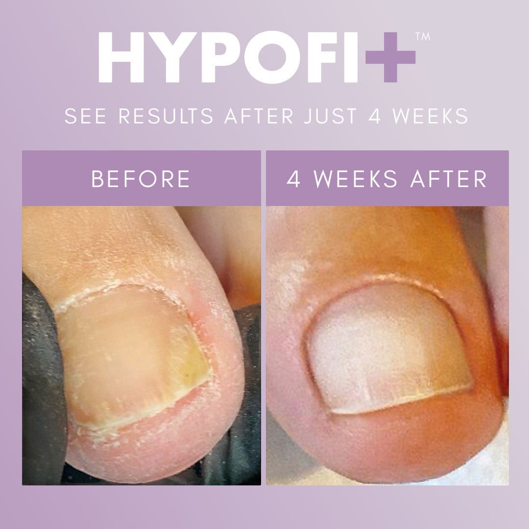 The GelBottle - HypoFix Repair Serum, 20ml