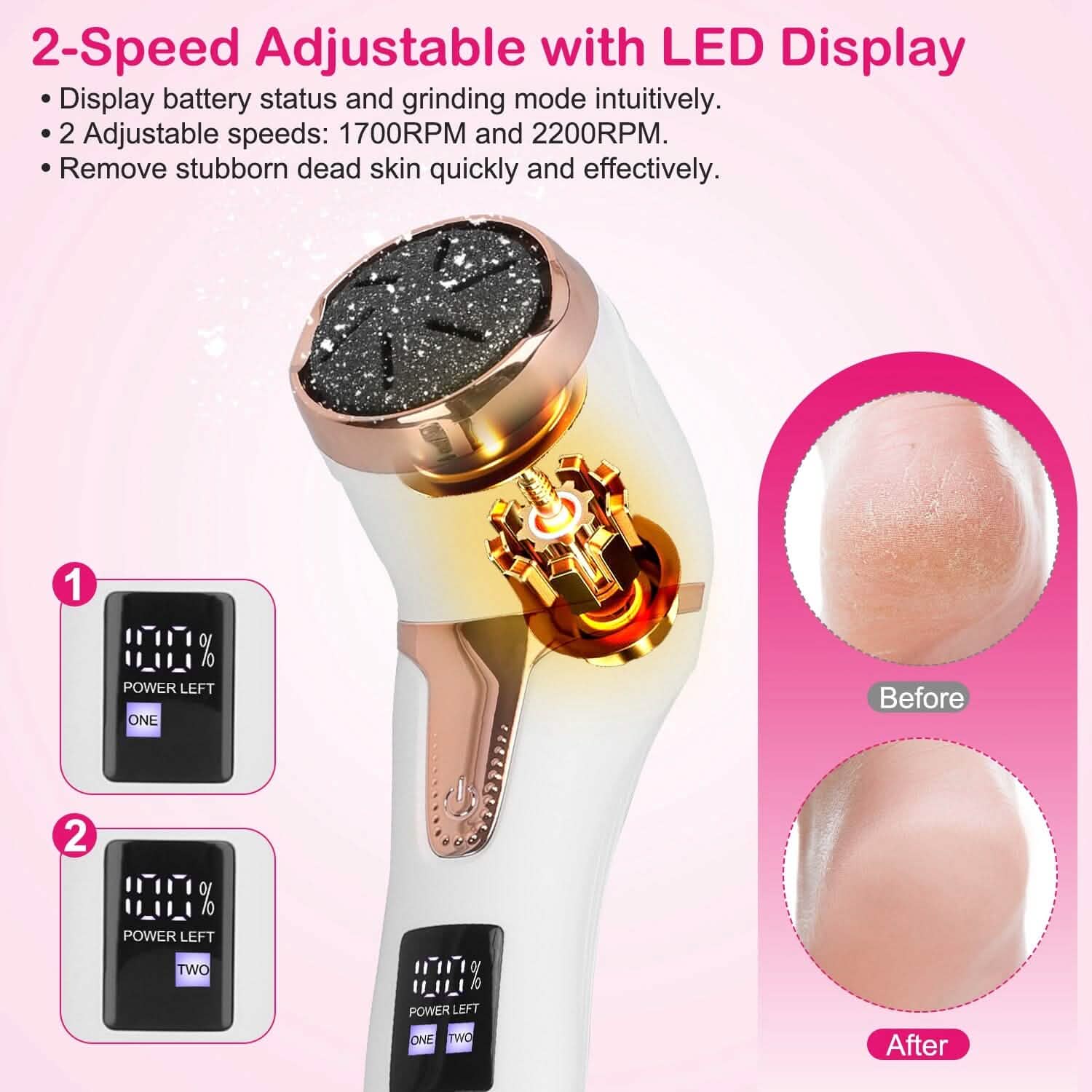 17-Pieces Set: Electric Foot Callus Remover with Vacuum Foot Grinder Rechargeable by DailySale