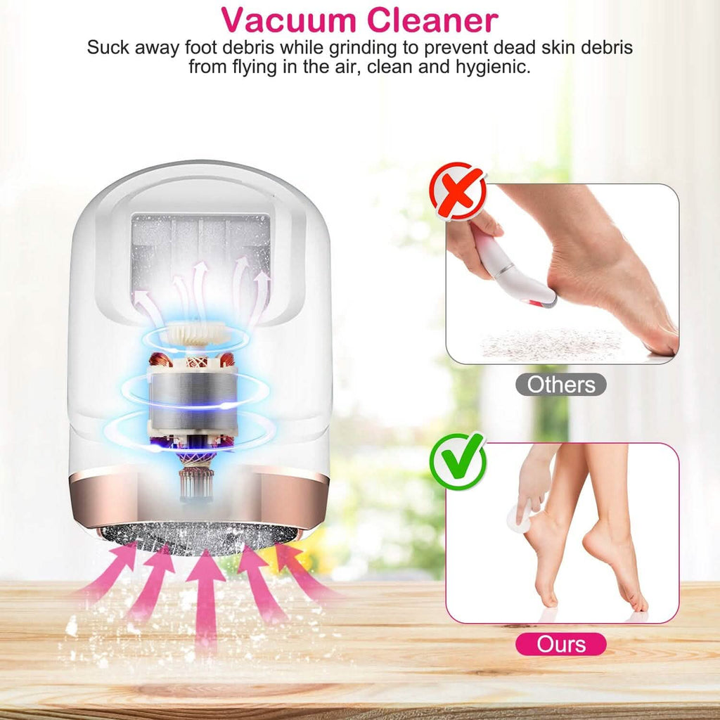 17-Pieces Set: Electric Foot Callus Remover with Vacuum Foot Grinder Rechargeable by DailySale