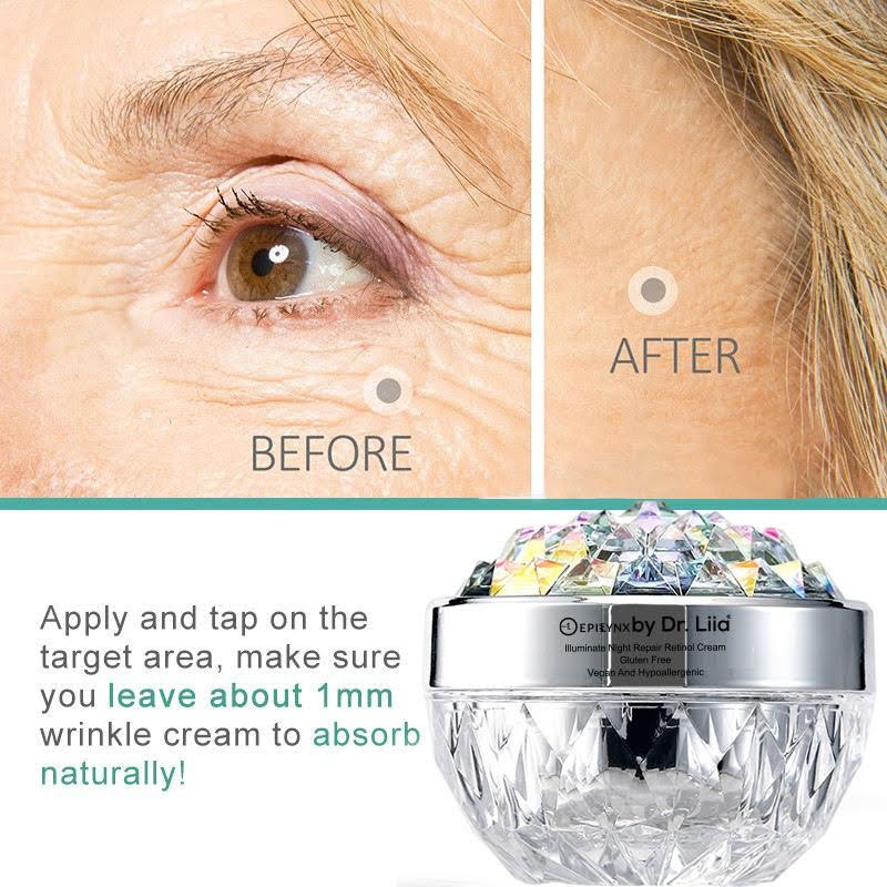 Anti-Aging Retinol Night Moisturizer – Hydrating, Vegan, Gluten-Free & Radiance-Boosting by EpiLynx