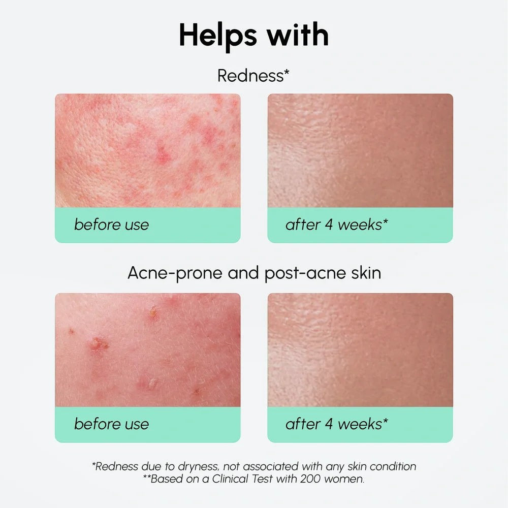 Redness Soothing Azelaic Acid Serum by Maree