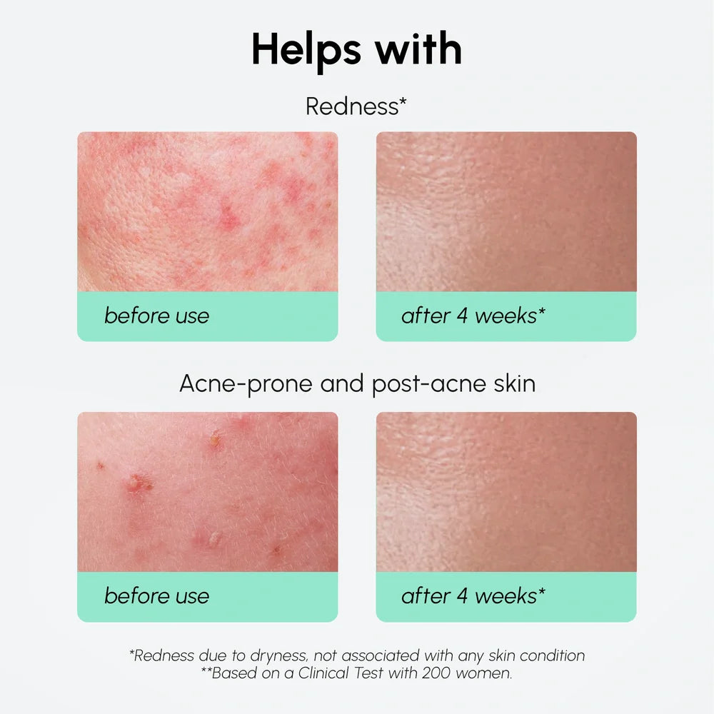 Redness Soothing Azelaic Acid Serum by Maree