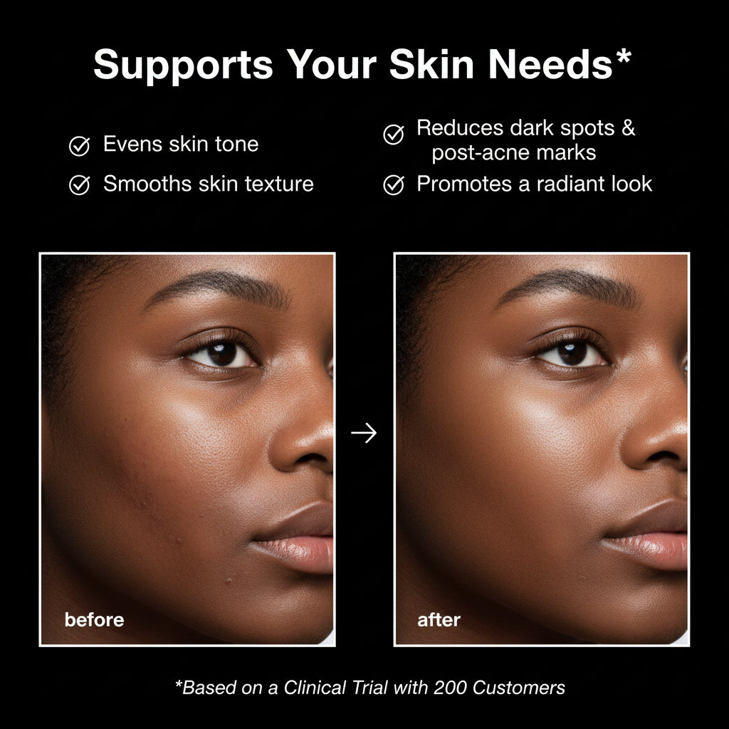 Azelaic Acid Cream for Sensitive Skin by Maree
