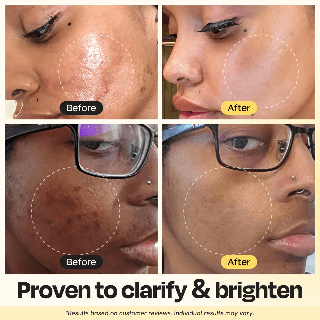 Vitamin C Clay Mask by Gleamin