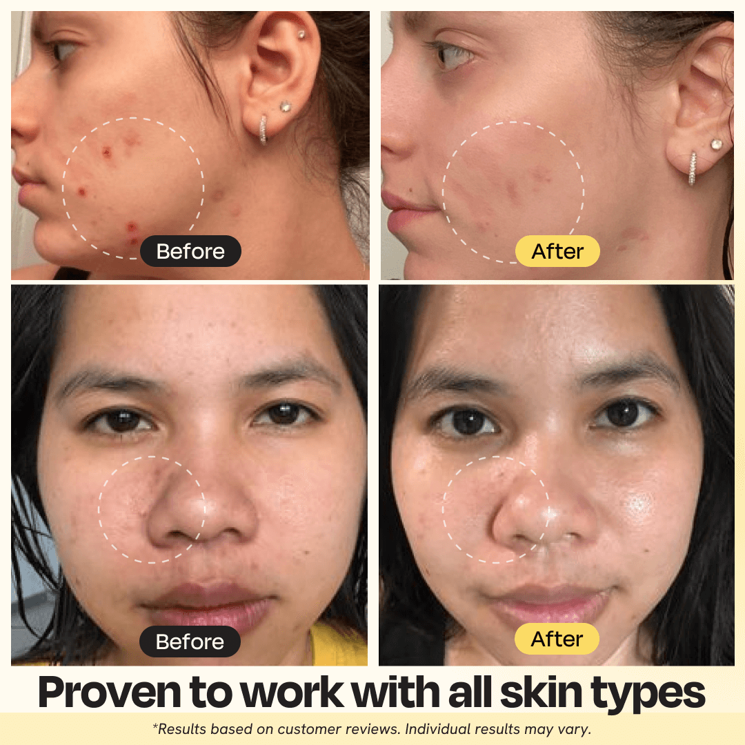 Vitamin C Clay Mask by Gleamin