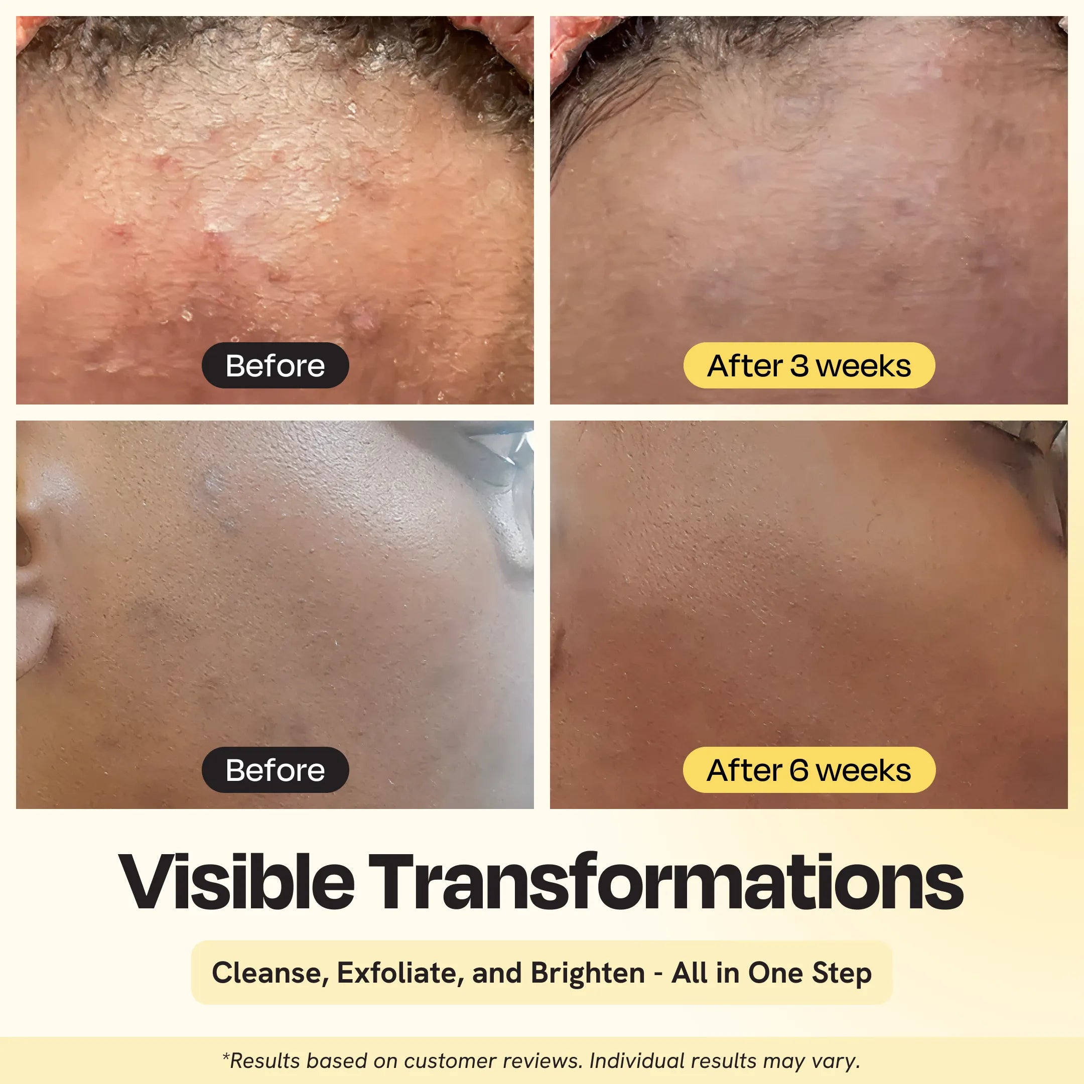 Clarifying Brightening Cleanser by Gleamin