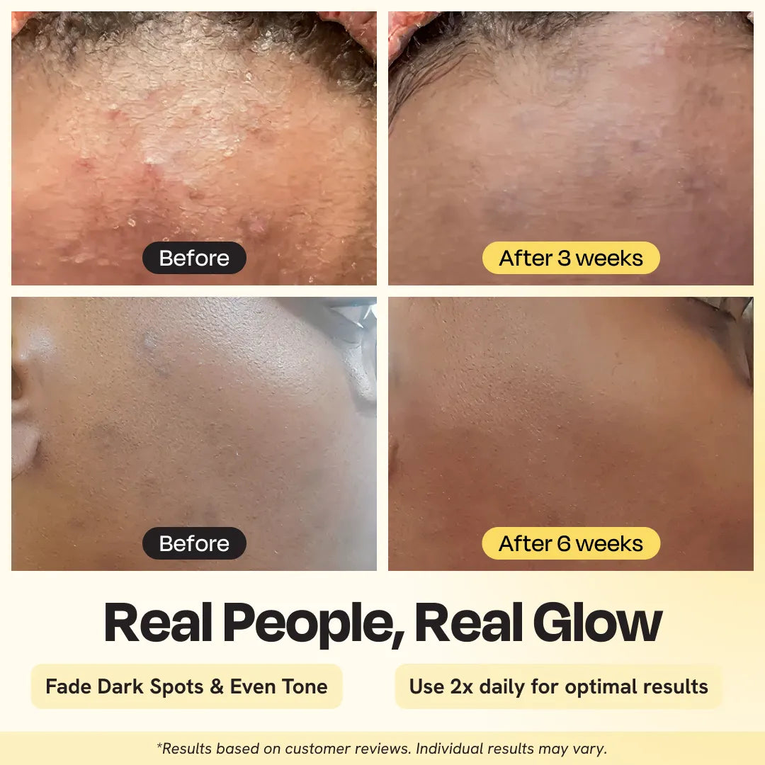 Advanced Brightening Moisturizer by Gleamin