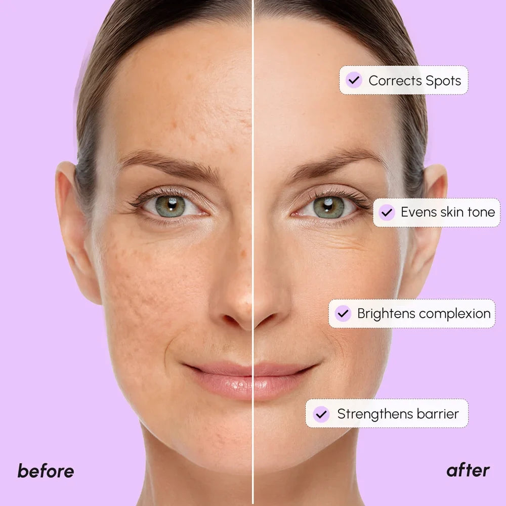 Dark Spot Corrector by Maree