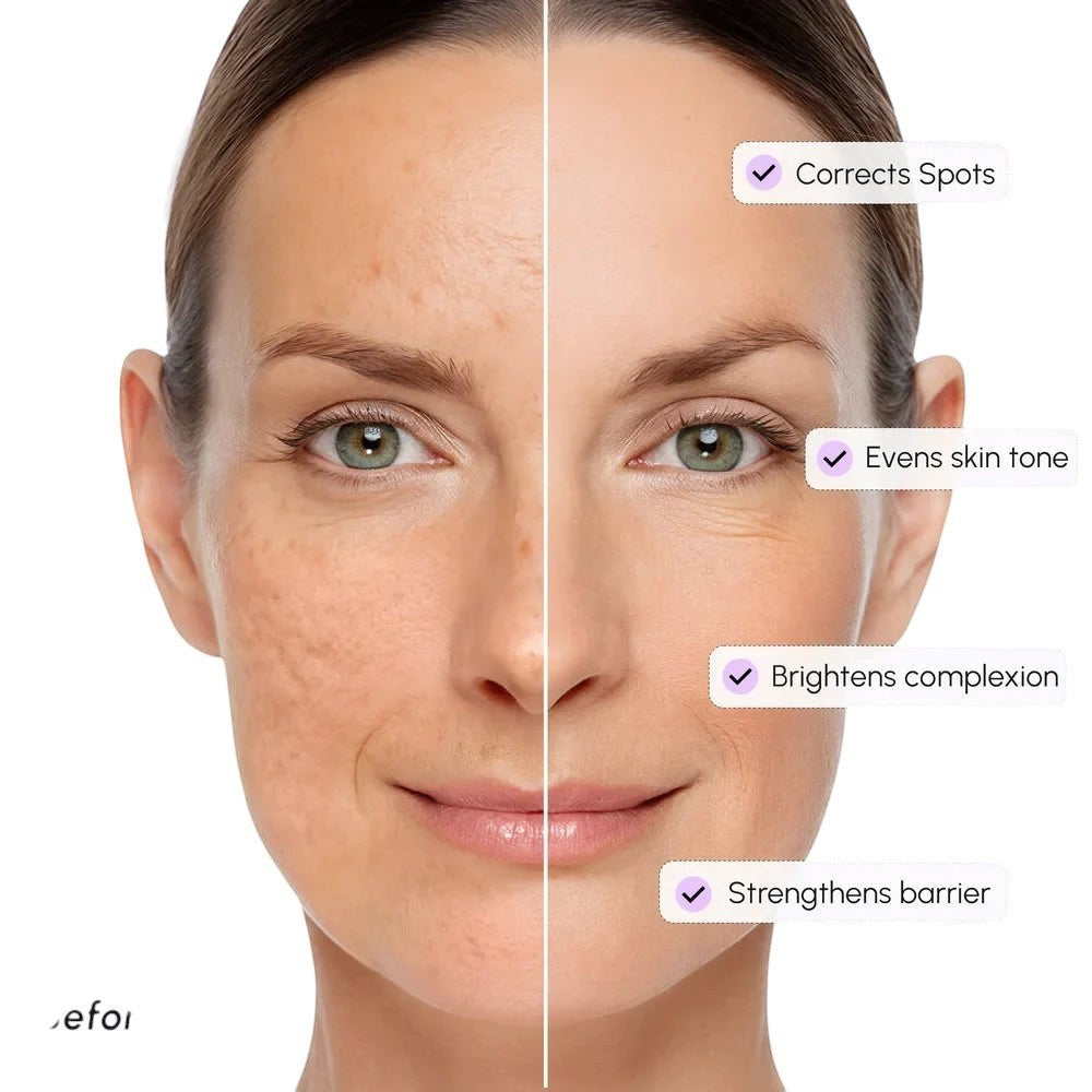 Dark Spot Corrector by Maree