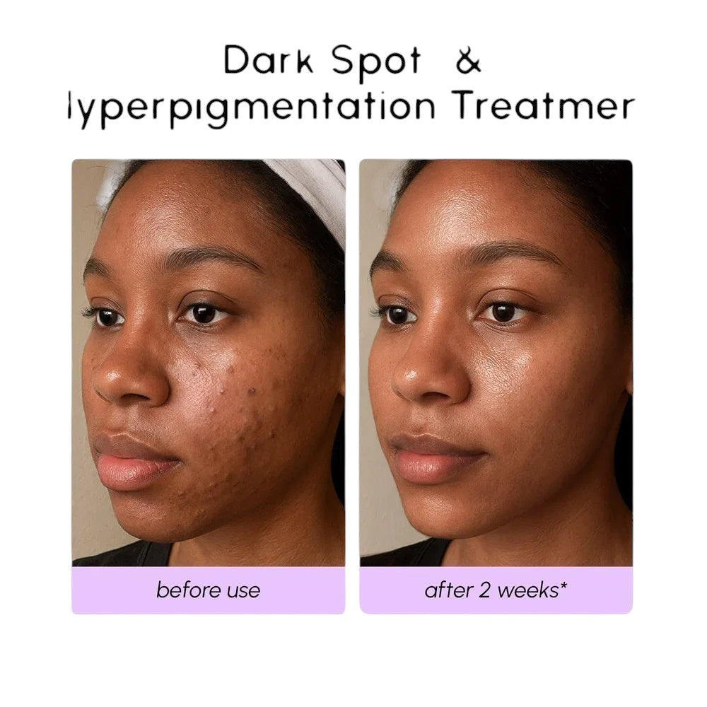 Dark Spot Corrector by Maree