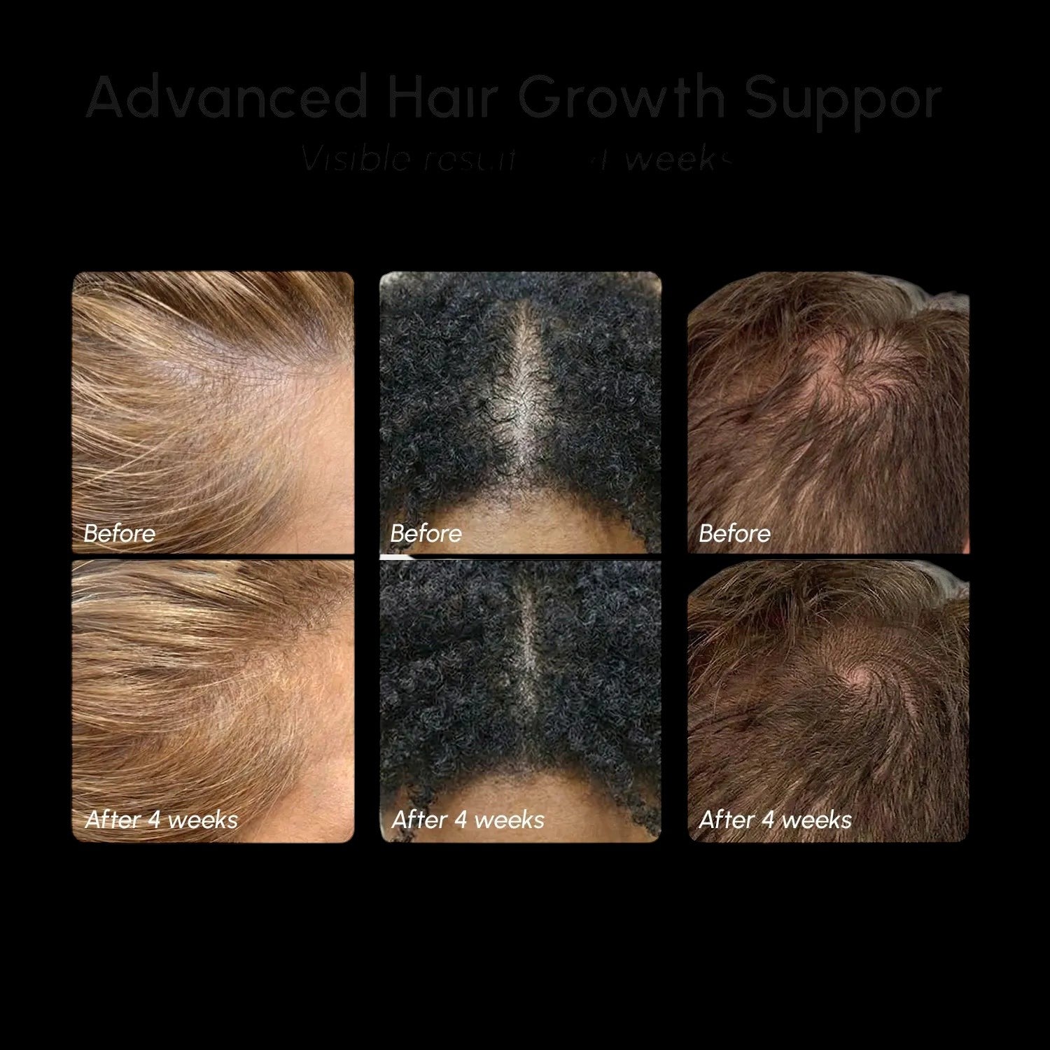 4-in-1 Hair Growth Spray by Maree