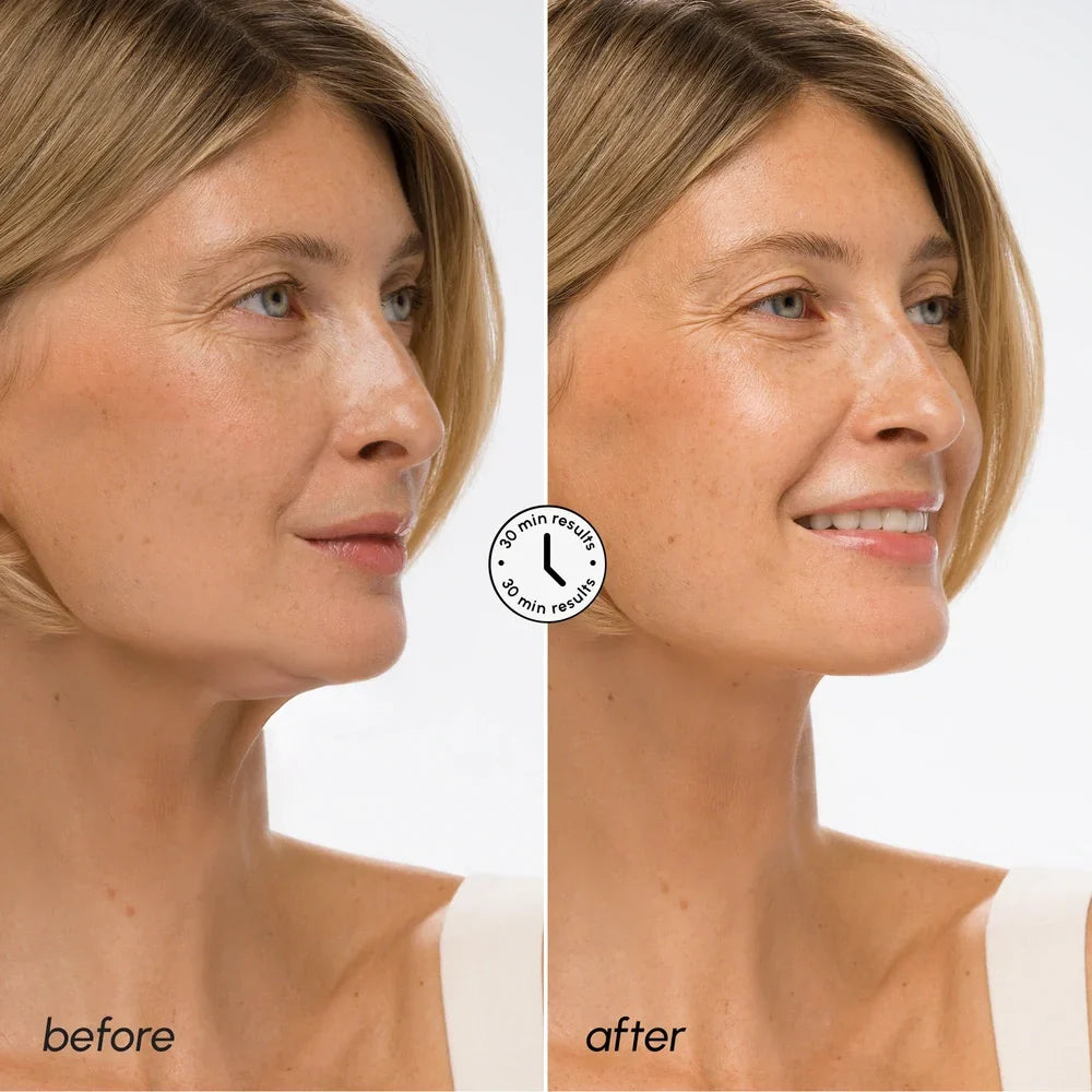 Hyaluronic Acid V-line Lifting Mask by Maree