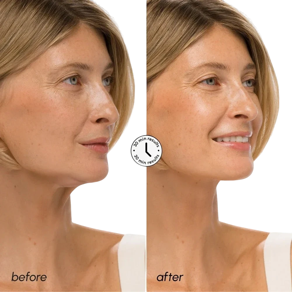 Hyaluronic Acid V-line Lifting Mask by Maree