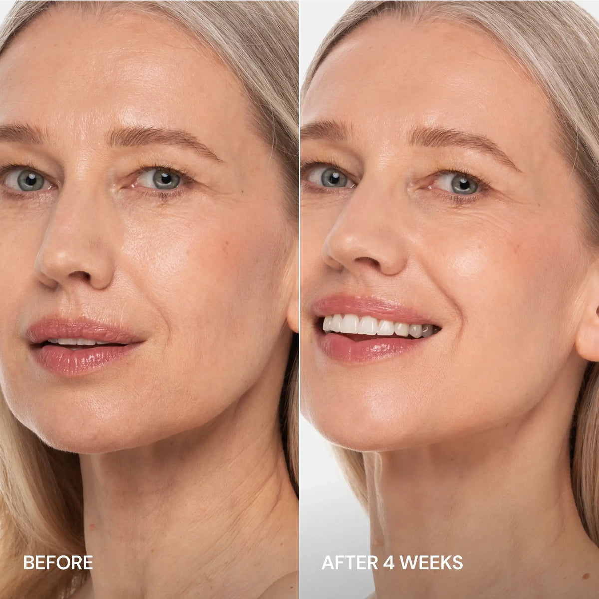 Pro-Retinol Neck Lifting Cream Massager by Maree