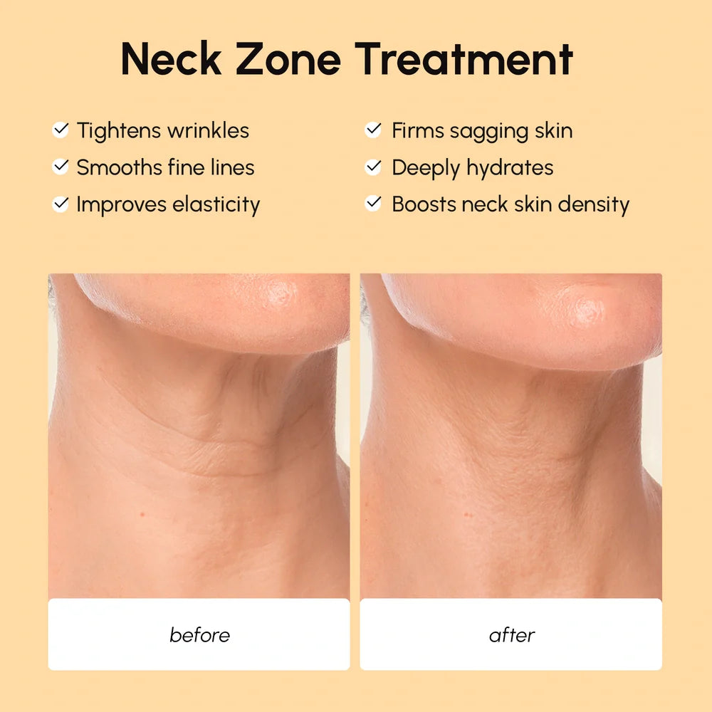 Lifting Neck Wrinkle Patches by Maree