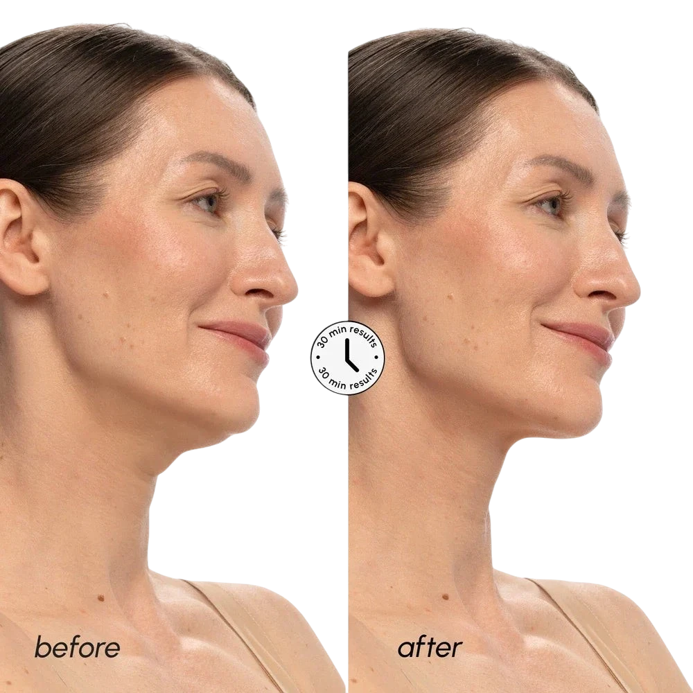 PDRN V-line Lifting Mask by Maree