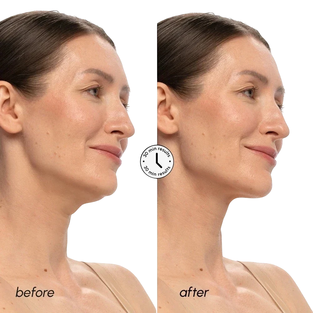 PDRN V-line Lifting Mask by Maree