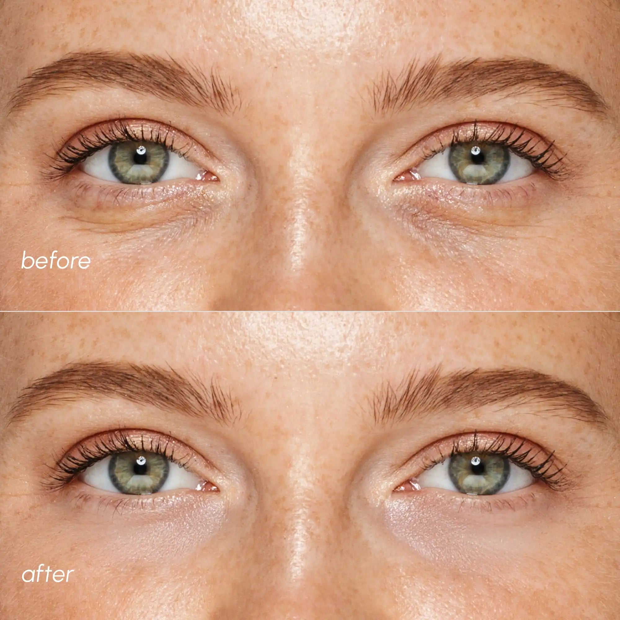 Pink Eye Patches for Puffy Eyes by Maree