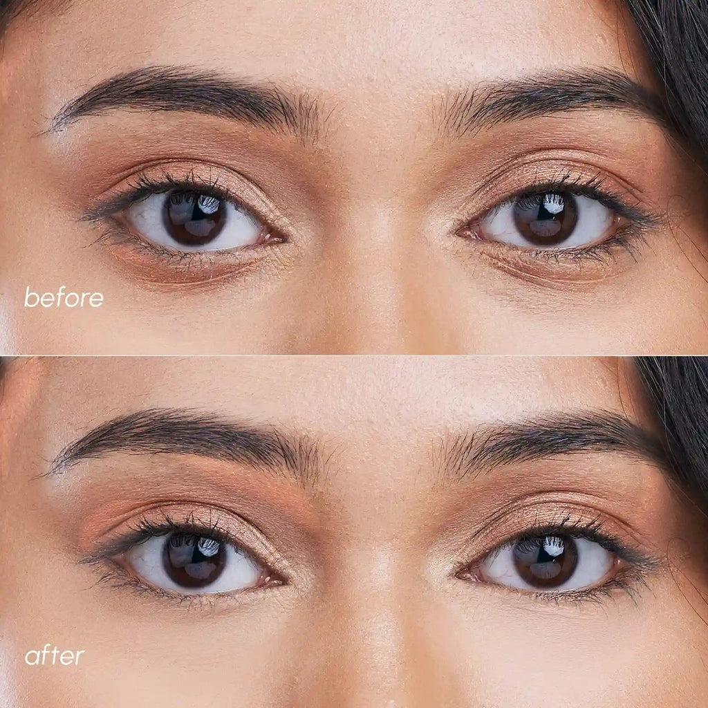 Pink Eye Patches for Puffy Eyes by Maree