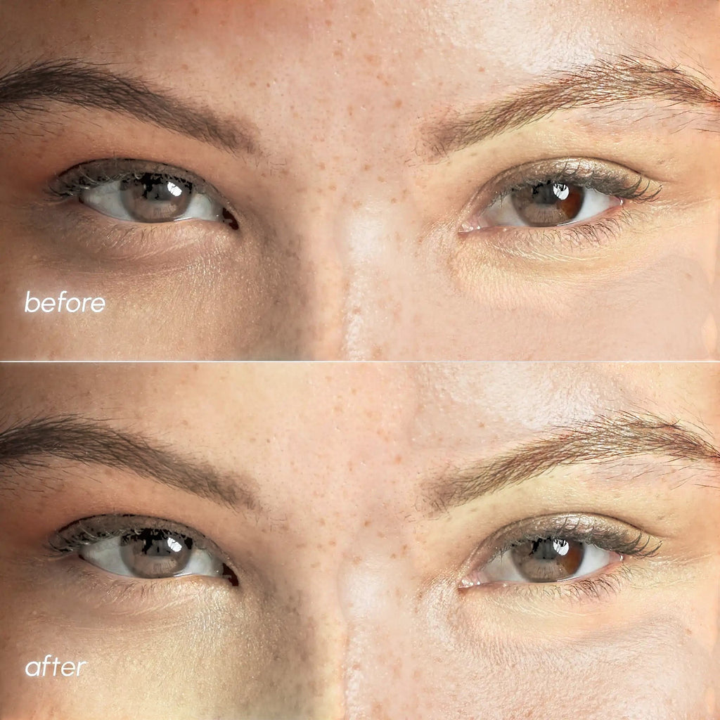Pink Eye Patches for Puffy Eyes by Maree