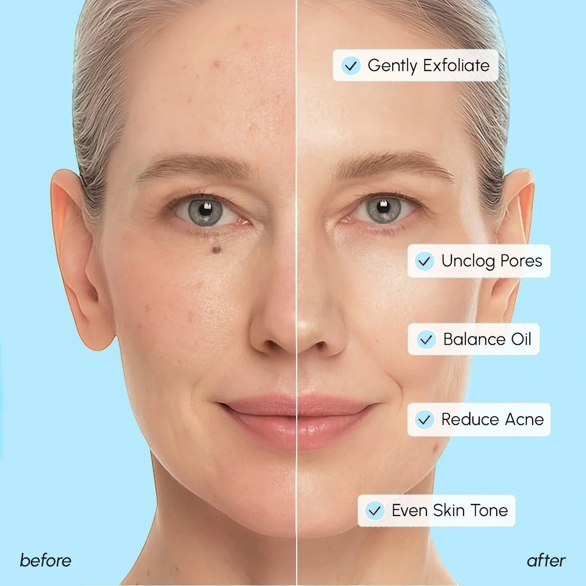 Glycolic & Salicylic Acid Peel Pads by Maree