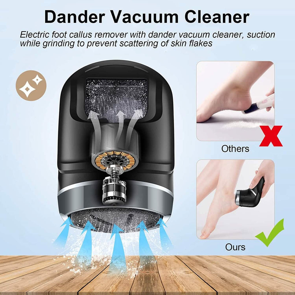 Electric Foot Callus Remover with Vacuum Cleaner by DailySale