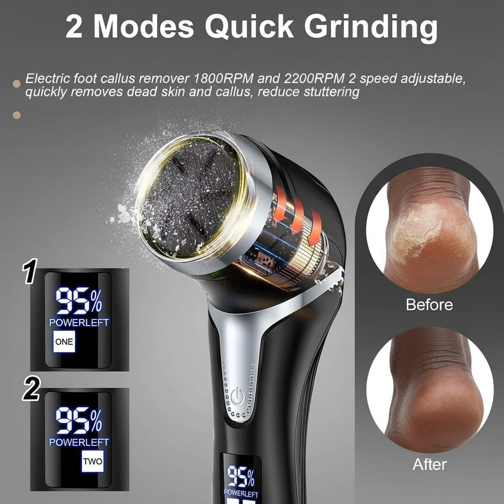 Electric foot callus remover with digital display and before-and-after effects on skin.