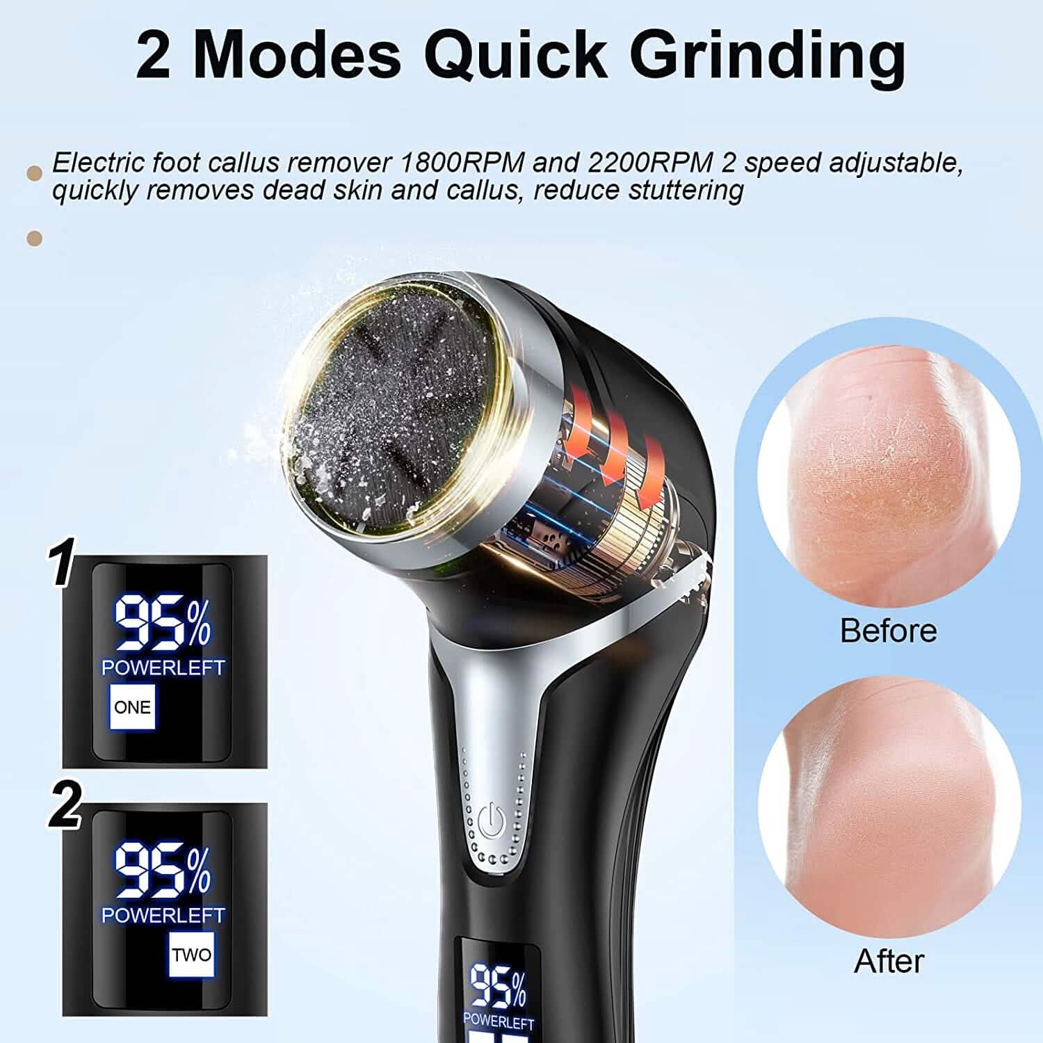 Electric Foot Callus Remover with Vacuum Cleaner by DailySale