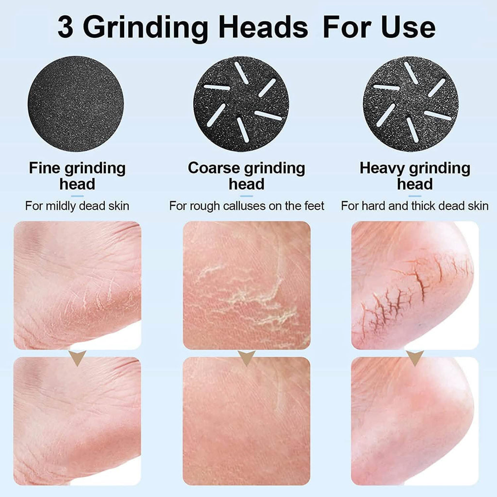 Electric Foot Callus Remover with Vacuum Cleaner by DailySale