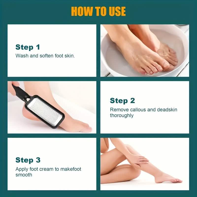4-Piece Stainless Steel Foot File Set – Callus & Dead Skin Remover by DailySale
